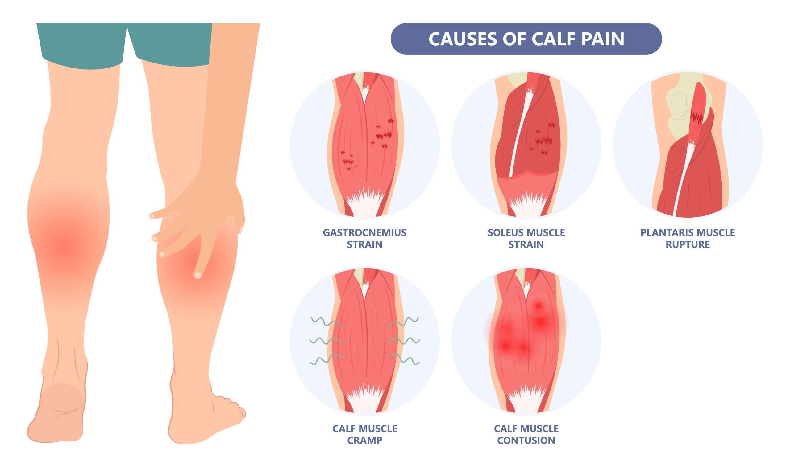 Physiotherapist screening a patient for calf pain red flags in a Rosanna clinic